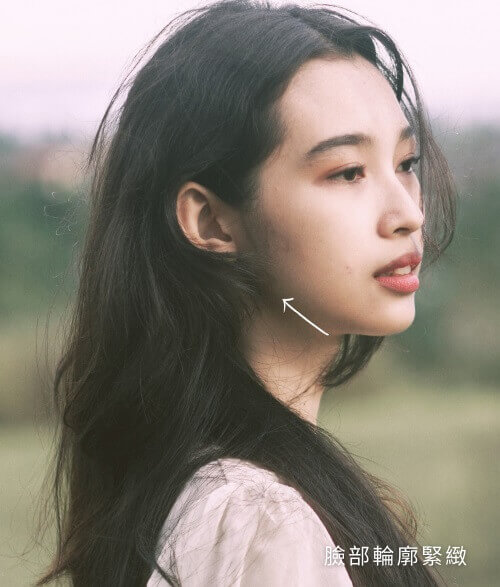 淨妍美容拉提緊緻課程