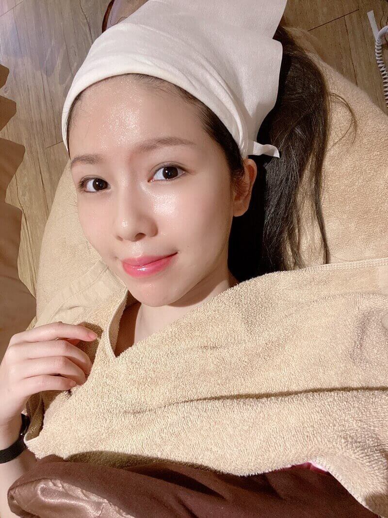 藍妍寧靠杏仁酸保濕療程逼出閉鎖型粉刺-20210715 藍妍寧靠杏仁酸保濕療程逼出閉鎖型粉刺