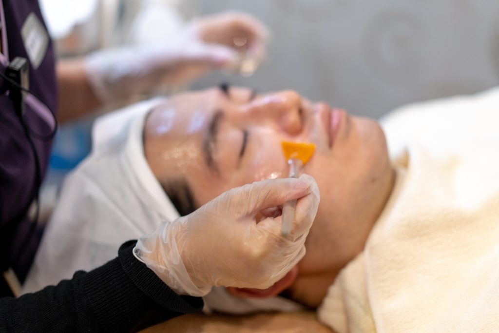 杏仁酸煥膚去除粉刺痘痘